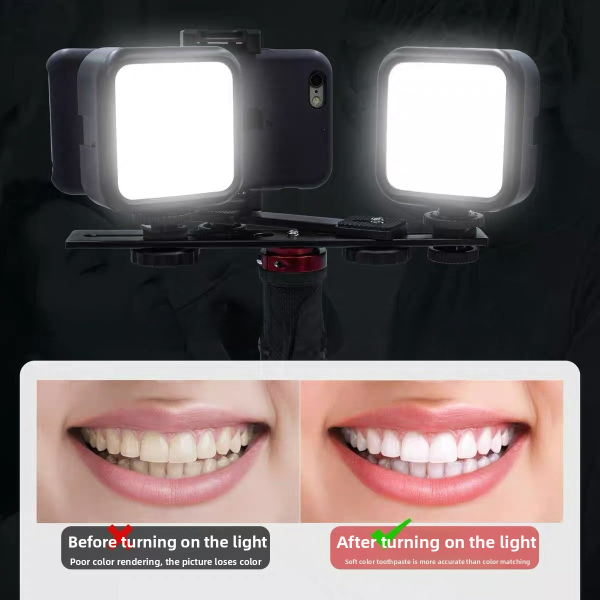 Photography Basics - Dental Photography Light with Bluetooth Oral